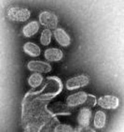 virus de la influenza AH1N1