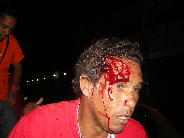 Compatriota Damián Sampallio, víctima de agresión por parte de simpatizantes enardecidos del derrotado Rosales