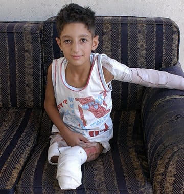 Mohamed Samer Elhaz Mouss, fotografiado en octubre de 2006, fue víctima de las bombas racimo cuando activó uno de estos artefactos, lanzado por fuerzas israelíes en su incursión al Lìbano en 2006.