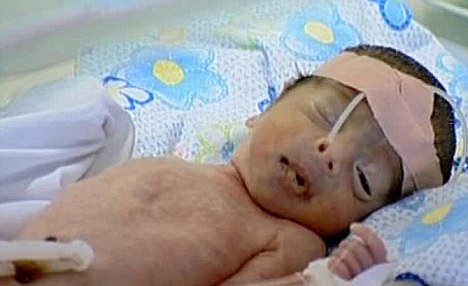 En Faluya se registran también defectos de nacimiento debido a uranio empobrecido