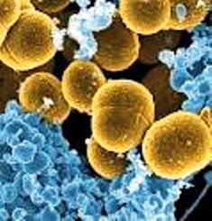 Bacterias huyendo de un ataque de leucocitos
