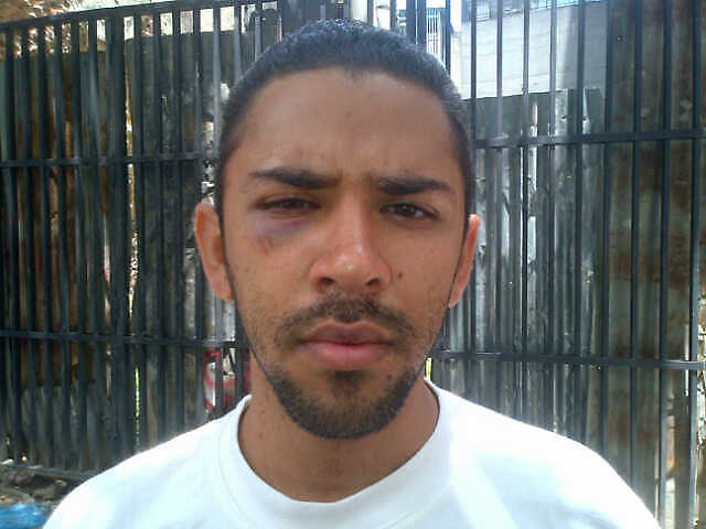 ALIS NOE GUEVARA salvajamente golpeado e injustamente aprehendido por funcionarios de la Policía de Caracas