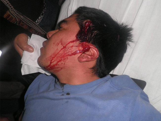 Violencia policial contra niños mapuche