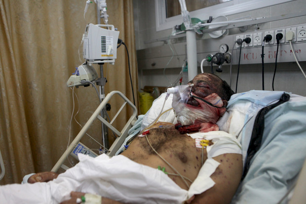 Doghmosh, de 40 años de edad, fue herido cuando su casa en el vecindario Sabra en la ciudad de Gaza fue bombardeada durante la ofensiva israelí de ocho días