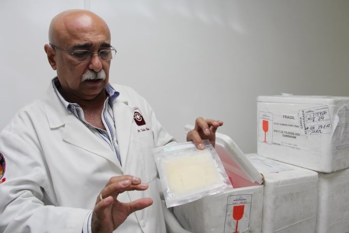 Dr. Tulio Chacín muestra la piel donada por Argentina