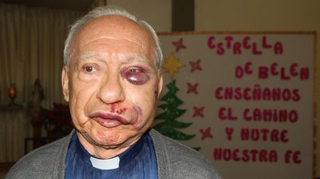 El sacerdote Marcos Antonio Robayo Cárdenas (80), fue golpeado y despojado de pertenencias