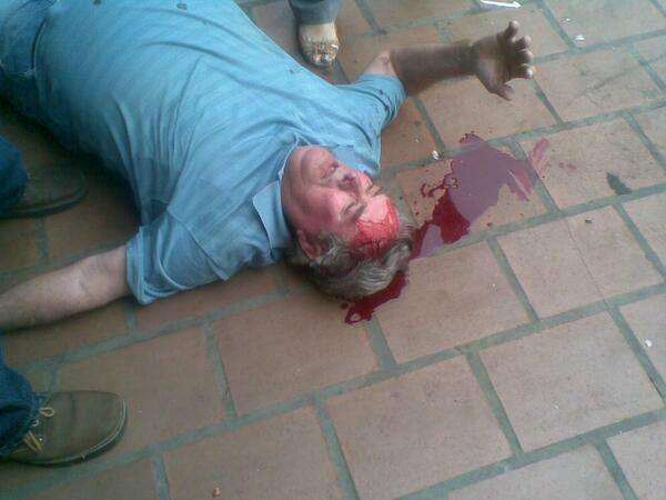 Opositores caprilistas hirieron a este hombre en ciudad Ojeda, Zulia, luego de que Capriles llamara a descnocer los resultados de las elecciones del 14-A