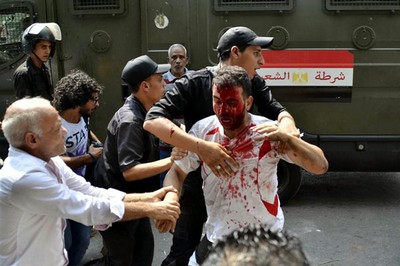 Cientos de civiles se han visto afectados por la represión de la policía