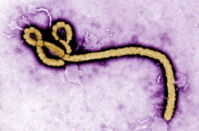 El virus del Ébola bajo el microscopio