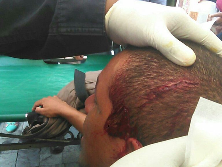 Oswaldo Rivero "Cabeza de Mango" fue herido en la cabeza