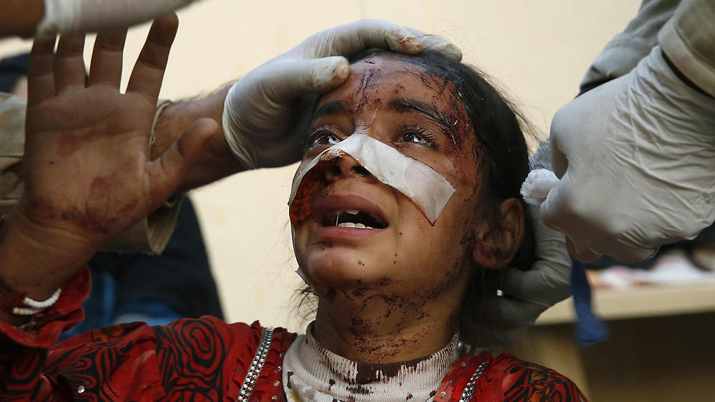 Manar Hassan, de 8 años de edad, llora mientras los médicos tratan de curar sus heridas después de un bombardeo suicida. Su padre murió en el ataque el cual debió ser dejado en los escombros.