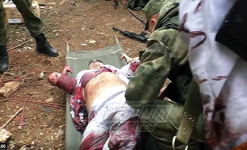 Médicos militares rusos intentaron en vano asistir a sus colegas gravemente heridas