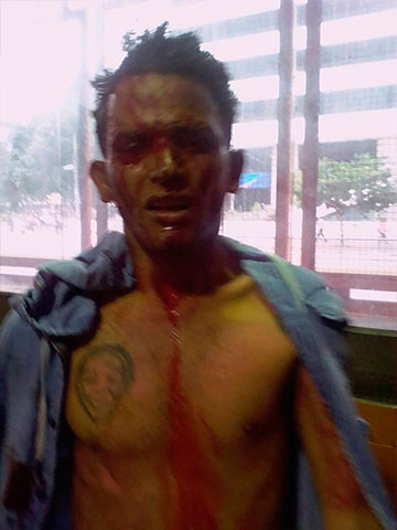 El joven agredido que hasta ahora no se ha podido identificar.