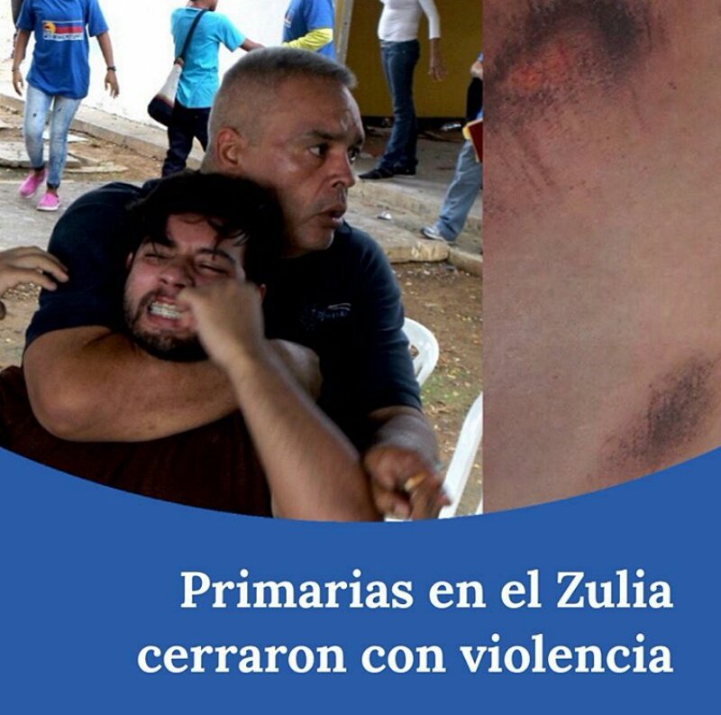 En Maracaibo la violencia se desbordó entre UNT y Primero Justicia.