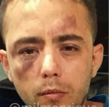 Apareció con vida, pero golpeado el periodista Jesús Medina