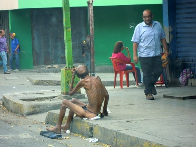 Hombre en visible estado de desnutrición; tomada el 6 de mayo del 2018 en la avenida Lara con Anzoátegui, estado Carabobo.