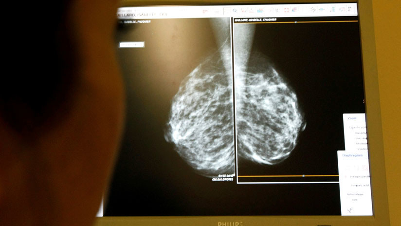 Un médico examina unas mamografías.