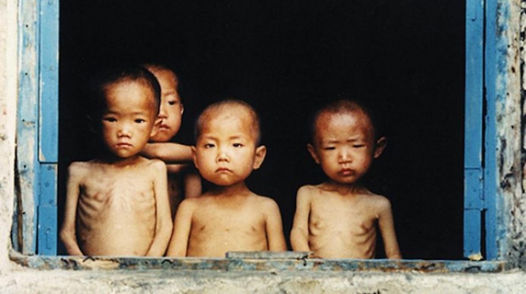 Niños desnutridos en Corea del Norte