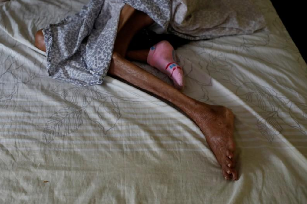 Las piernas de Sibilina Caro se ven mientras descansa en la cama de su hija Judith Palmar en Maracaibo, Venezuela, el 25 de julio de 2018