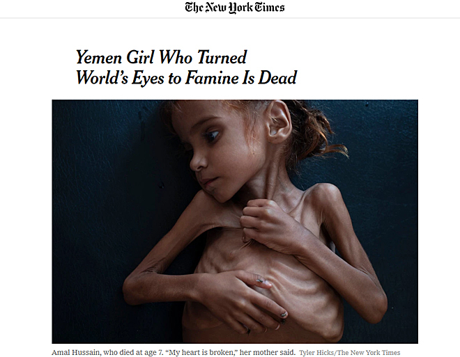 Imagen de la niña de Yemen, publicada por el New York Times