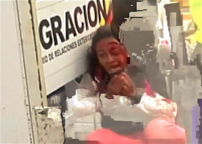 Periodista chilena víctima de accidente ocasionado por tanqueta secuestrada por desertor