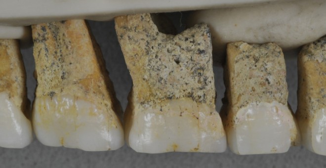 Dentadura superior derecha de Homo luzonensis