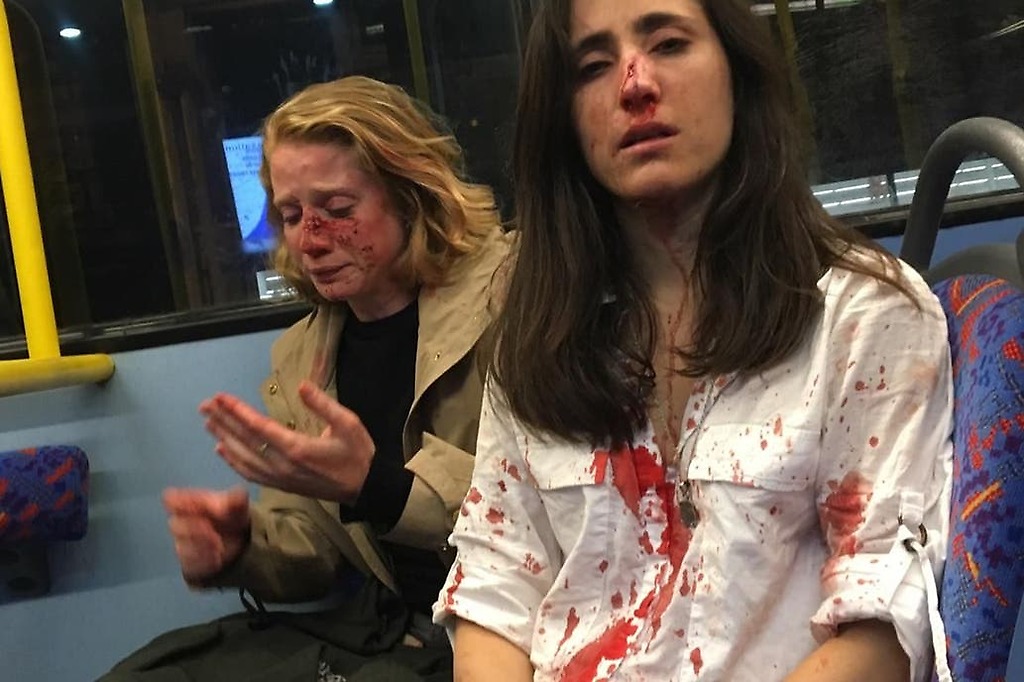 Melania Geymonat y su novia Chris agredidas en una autobús en Londres.