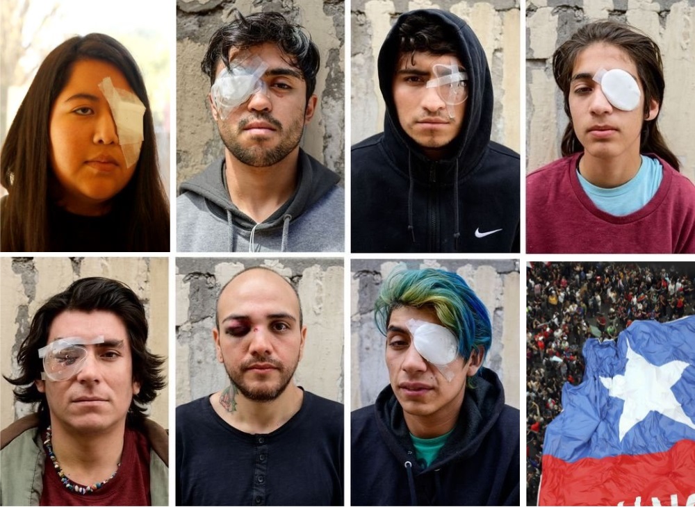 Piden justicia quienes han sido víctimas de daños oculares en Chile