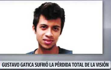 Gustavo Gatica estudiante chileno que perdió sus ojos por disparos de carabinero