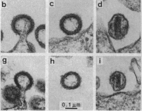 Vista con microscopio electrónico de un ataque de virus a células sanas