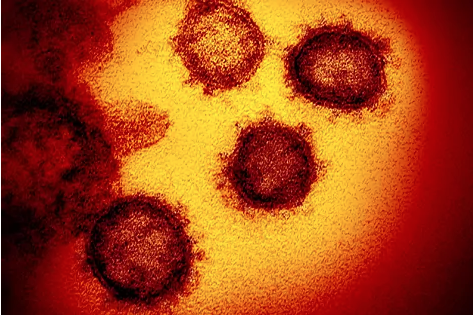 Imagen microscópica del SARS-CoV-2, el virus que causa el Covid-19.