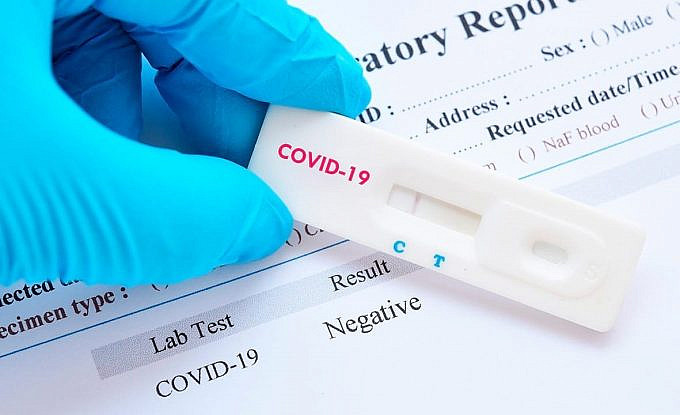 Test para Covid-19 o Coronavirus