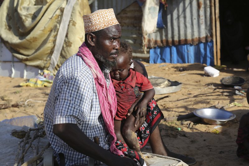Hombre con su familia en campamento improvisado en Mogadiscio, Somalia