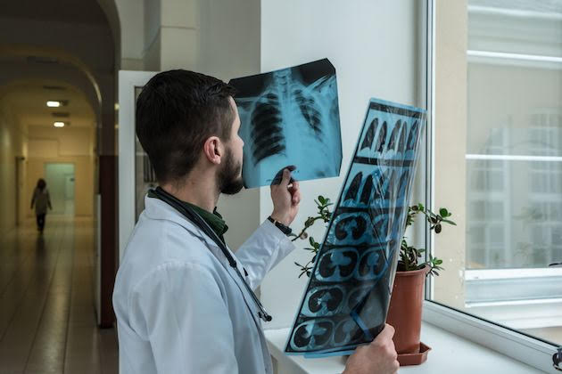 Médico examina radiografías