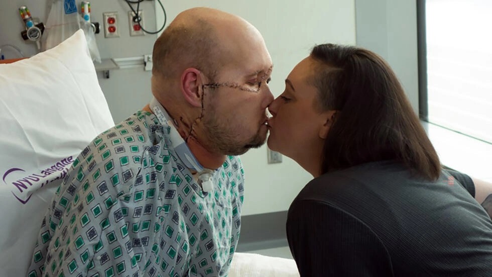 Aaron James (I) besa a su esposa Meagan mientras se recupera del primer trasplante de ojo entero y cara parcial, en el NY Langone Health de Nueva York.